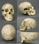 Human Female Skull with Multiple Gunshot Wounds Replica