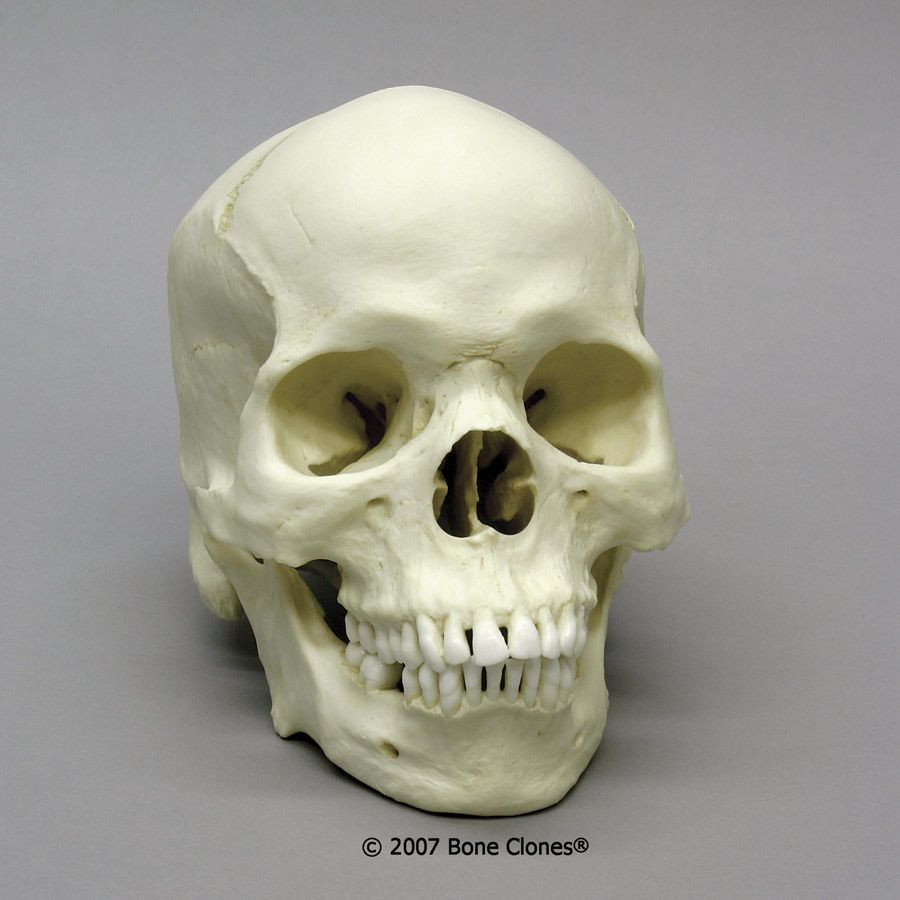 Human Male African-American Skull - Bone Clones, Inc. - Osteological