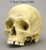 Human Male Skull with Hammer Blows