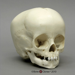 1-year-old Human Child Skull BC-274