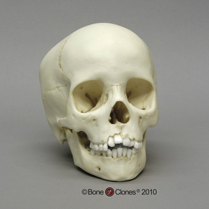 8-year-old Human Child Skull BC-276