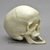 Human Female Achondroplasia Dwarf Skull BC-279