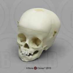 1-year-old Human Child Skull BC-280