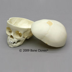 1-year-old Human Child Skull BC-280