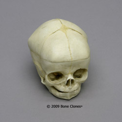 Fetal Human Skull BC-281