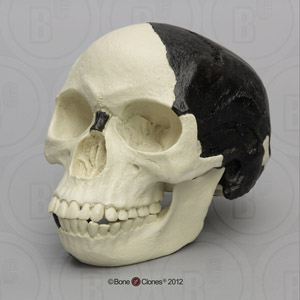 Piltdown Man Skull 1912 Fraud BH-014