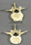 Two Piece Comparative Lumbar Vertebra Set