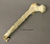 Human Femur with Remote Amputation