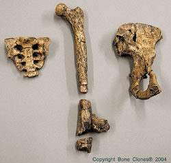 Australopithecus afarensis, Lucy, Innominate, Sacrum and Femur Set KO-036-PF