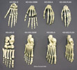 Skeltal Hands and Feet