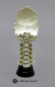 Human Cervical Vertebrae and Occipital Assembly KO-249
