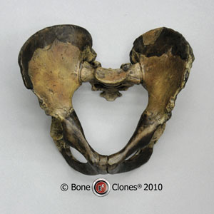 Homo ergaster KNM-WT 15000 Pelvis Assembly KO-313-P