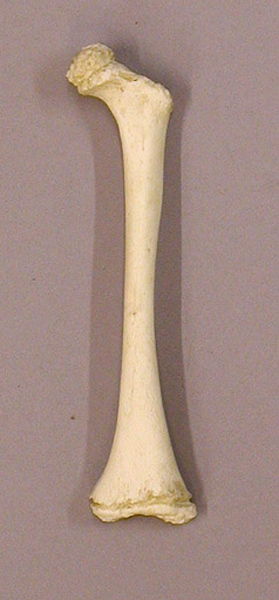 Child Femur