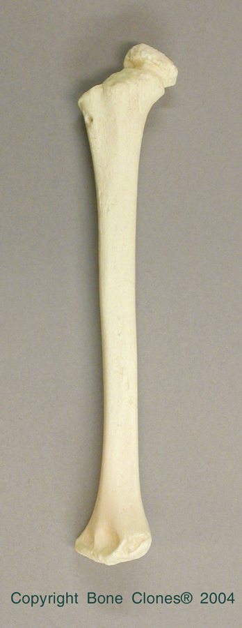 Bones Of Humerus