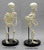 Human Female Achondroplasia Dwarf Skeleton, Articulated SC-279-A