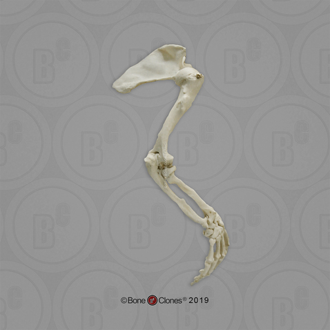 Human Female Achondroplasia Dwarf Arm, Articulated with Scapula