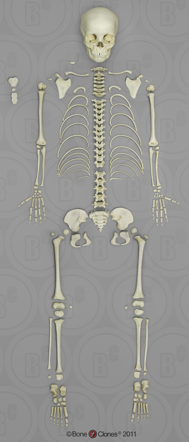 5-year-old Human Child Skull with Mixed Dentition Exposed & Calvarium ...