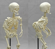 Pathology & Trauma Skeletons