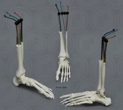 Physical Therapy / Joints