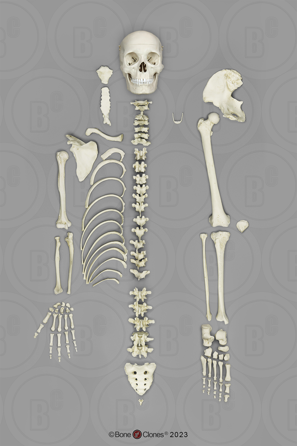 Human Female Asian Half Skeleton Bone Clones Inc Osteological Reproductions