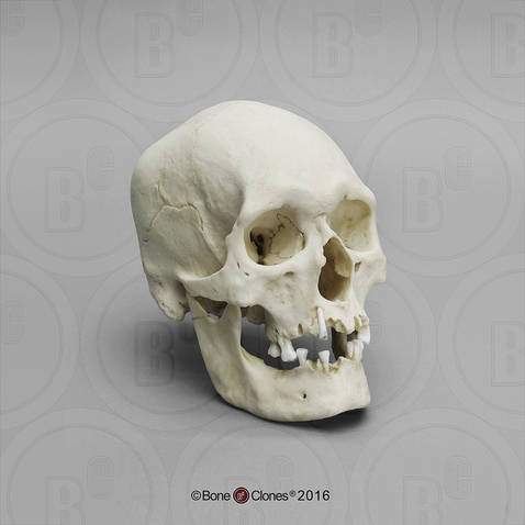 Human Male Polynesian Skull
