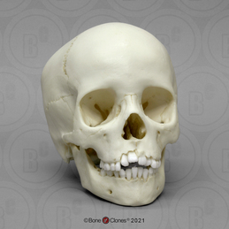 8-year-old Human Child Skull
