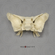 Human Sphenoid In Plastic Case