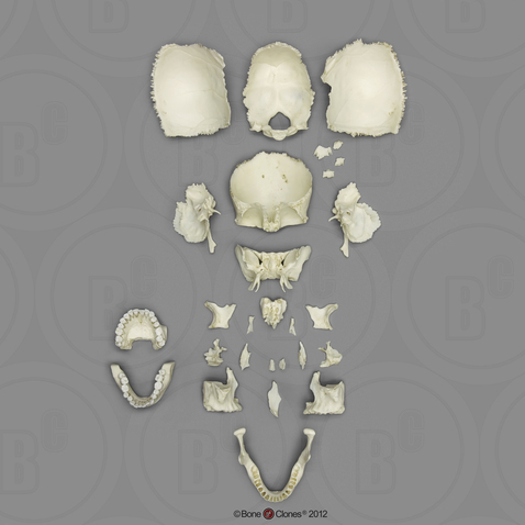 Disarticulated Human Medical Study Skull