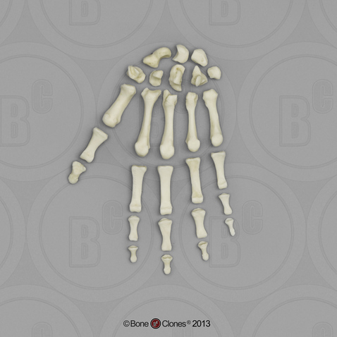 Human Adult Female Hand, disarticulated