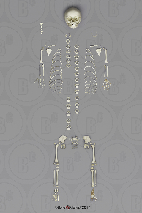 Disarticulated Human 14 to 16-month-old Child Skeleton and Individual Bones