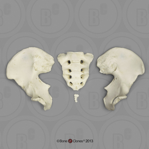 Human Male Asian Robust Pelvis, Disarticulated