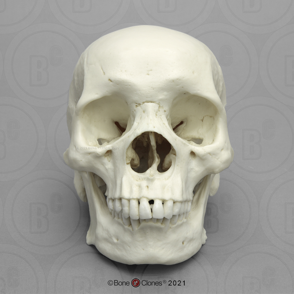 Human Male African Skull - Bone Clones, Inc. - Osteological ...