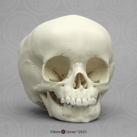 Human Child 15-month-old Skull