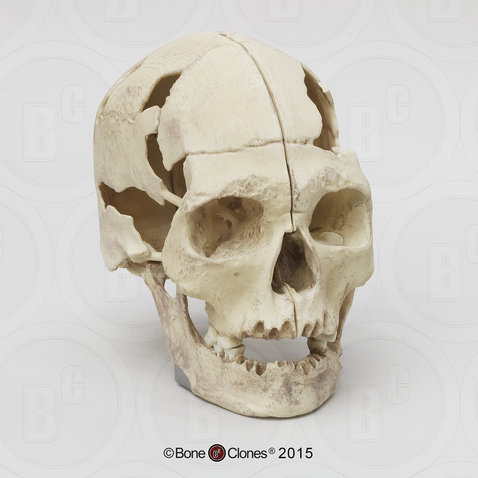 H. sapiens Oase Sagittal Cut Skull Without Reconstruction