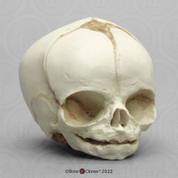 Fetal Human Skull 31 Weeks