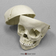 5-year-old Human Child Skull with Mixed Dentition Exposed & Calvarium Cut