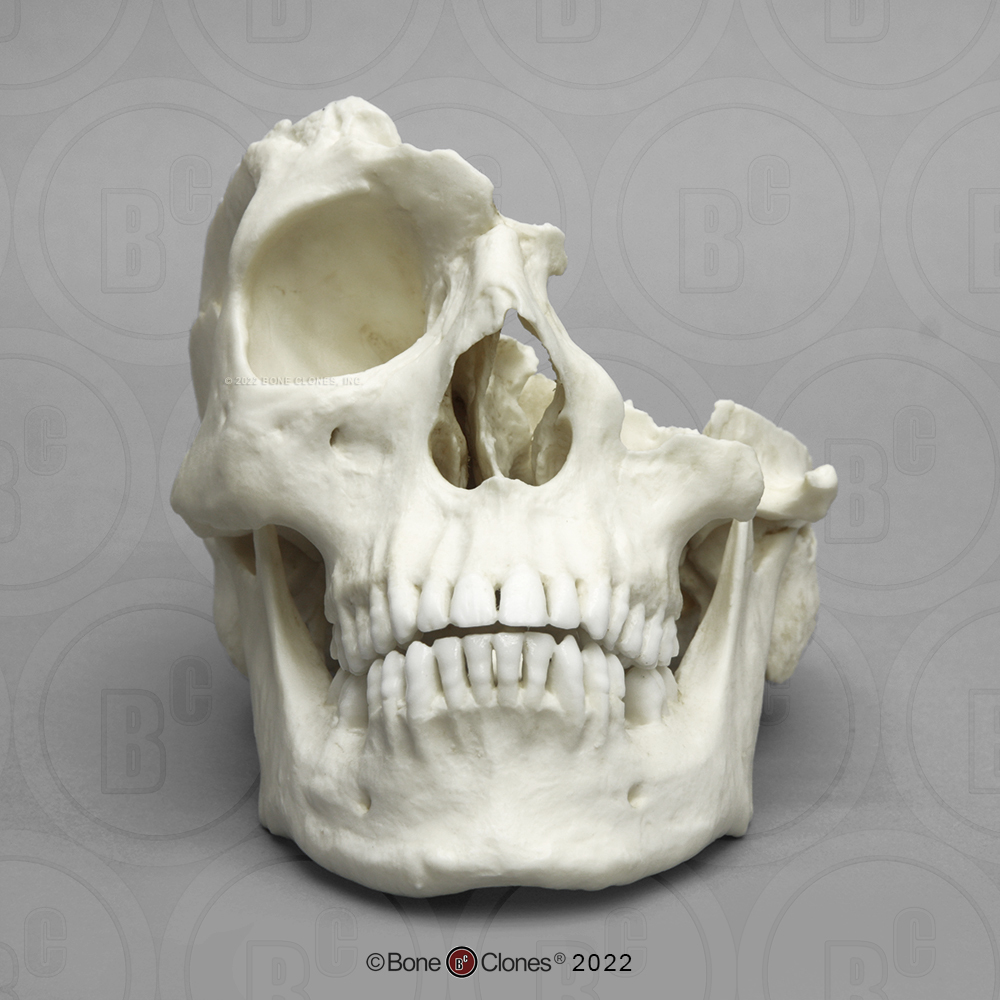 Human Male African Skull - Bone Clones, Inc. - Osteological