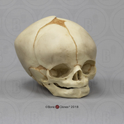 Fetal Human Skull 40 1/2 Weeks