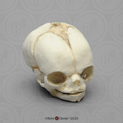 Fetal Human Skull 21 1/2 Weeks