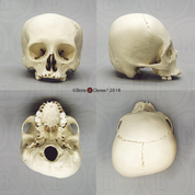 Adult Human Female Cradle Boarded Skull