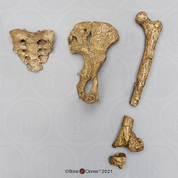 Australopithecus afarensis, "Lucy", Innominate, Sacrum and Femur Set