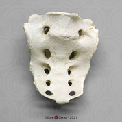 Human 65-year-old Male Sacrum and L-5 fused