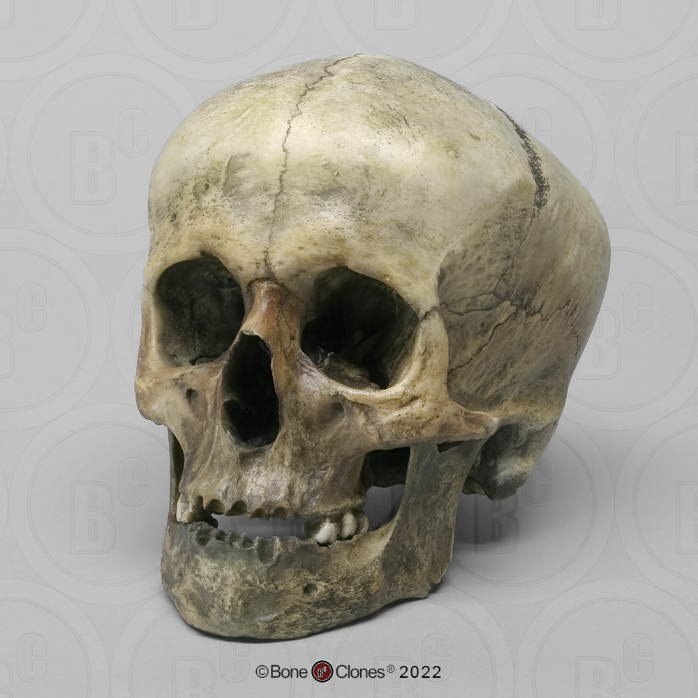 Roman Gladiator Human Skull - Bone Clones, Inc. - Osteological ...
