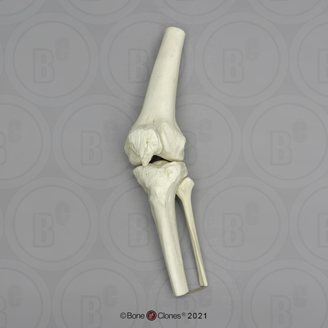 Human Knee Joint, Articulated