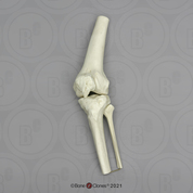 Human Knee Joint, Articulated