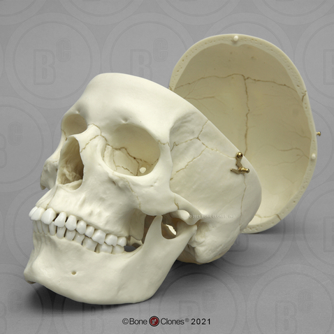 Human Female European Skull with Calvarium Cut