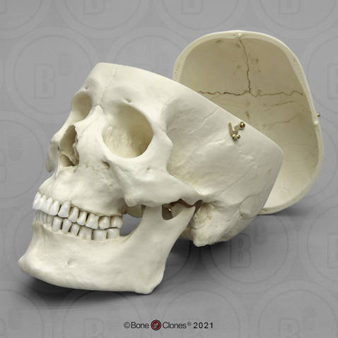 Male Human Adult Asian Skull with Calvarium Cut