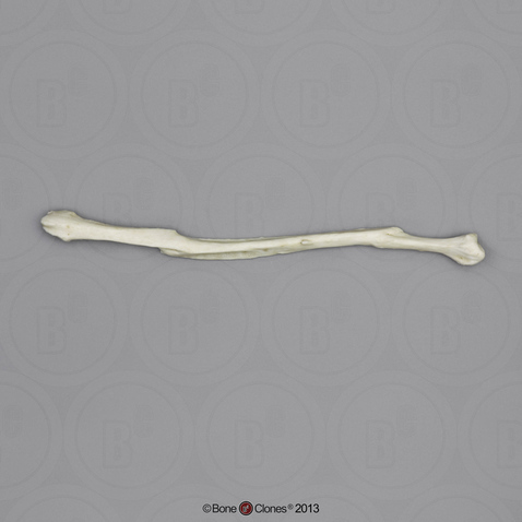 Human Left Fibula with Healed Fractures