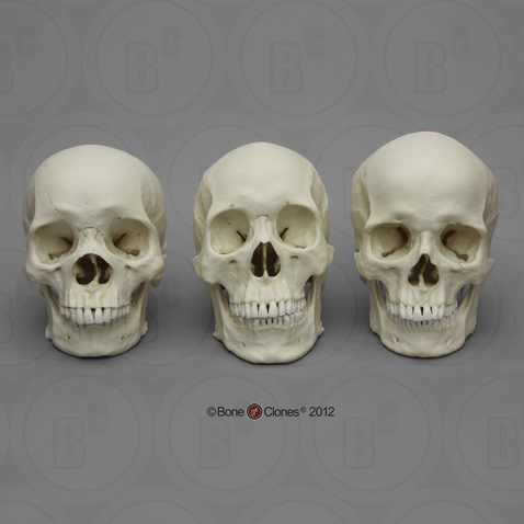 Human Male Skulls: African, Asian, and European