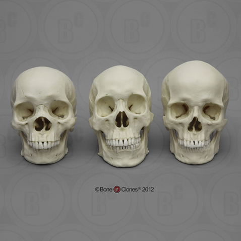 Human Male European Skull - Bone Clones, Inc. - Osteological Reproductions